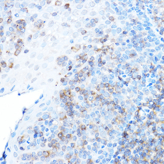 ULBP1 Rabbit pAb