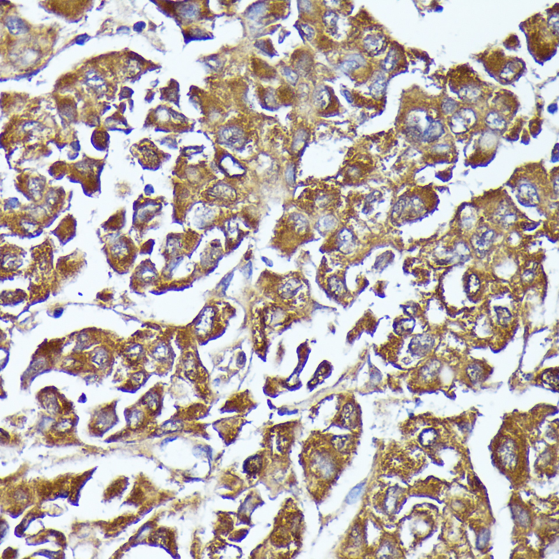 AKR1C2 Rabbit pAb