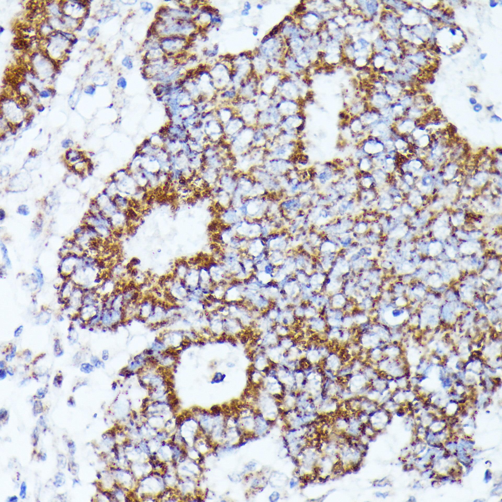 AKR1C2 Rabbit pAb