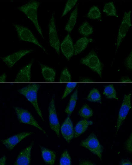 AKR1C2 Rabbit pAb