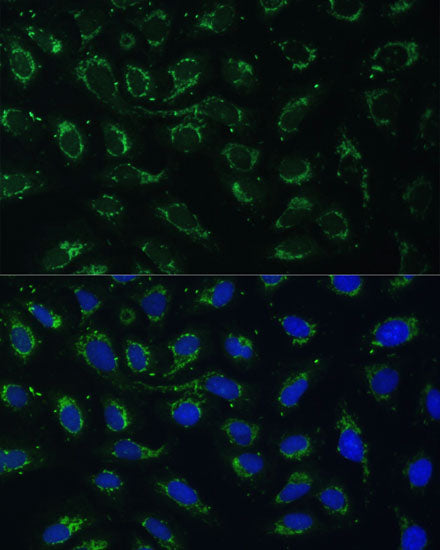 AKR1C2 Rabbit pAb
