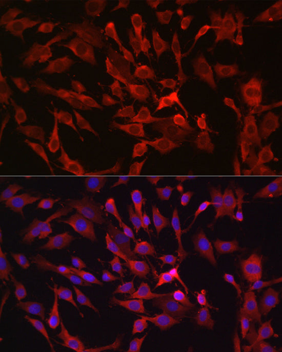 RASGRP1 Rabbit pAb