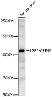 LGR5/GPR49 Rabbit pAb
