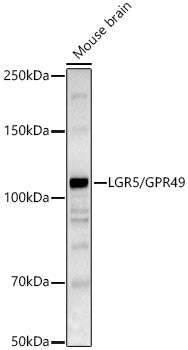 LGR5/GPR49 Rabbit pAb