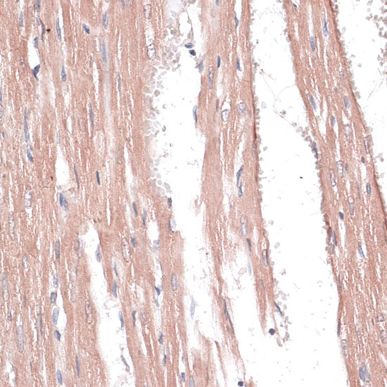 COL11A1 Rabbit pAb