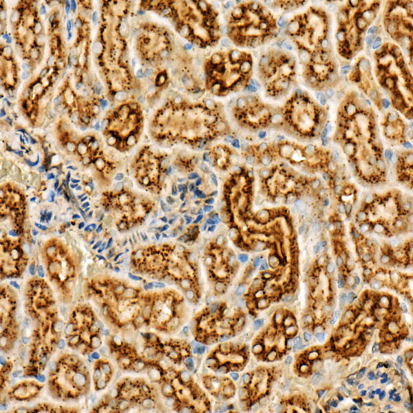 Legumain (LGMN) Rabbit pAb