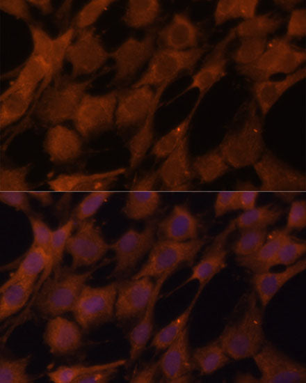 Legumain (LGMN) Rabbit pAb