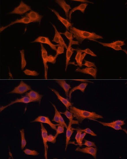 Legumain (LGMN) Rabbit pAb