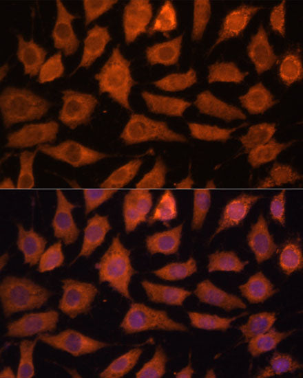 Legumain (LGMN) Rabbit pAb