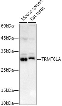 TRMT61A Rabbit pAb