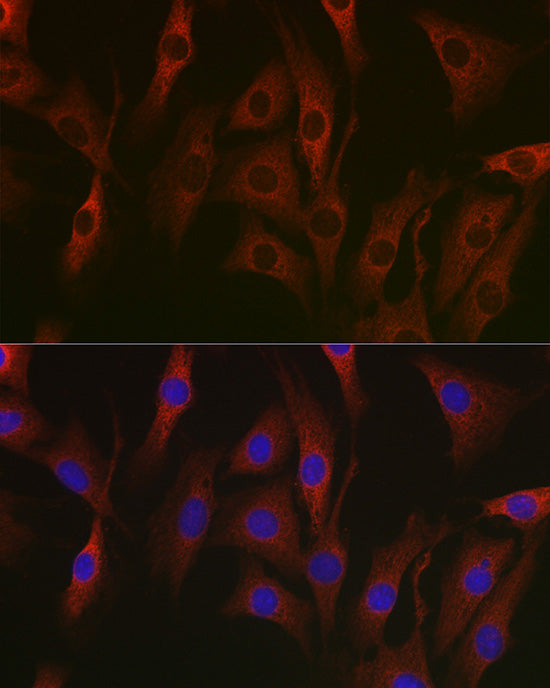 NF-kB p65/RelA Mouse mAb