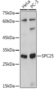 SPC25 Rabbit pAb