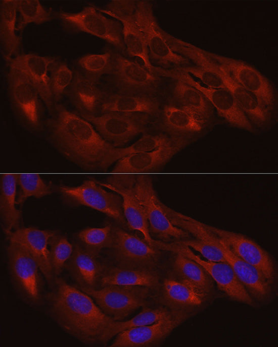 Calreticulin Rabbit pAb