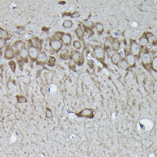 Calreticulin Rabbit pAb