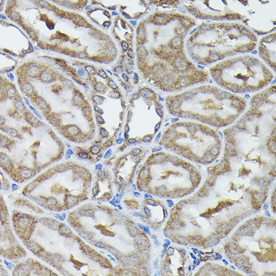 Calreticulin Rabbit pAb
