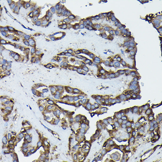 Calreticulin Rabbit pAb