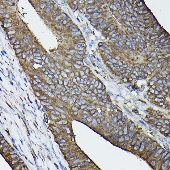 Calreticulin Rabbit pAb