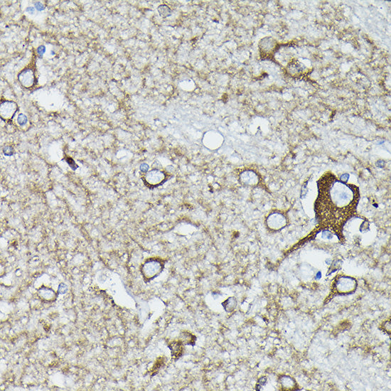 Calreticulin Rabbit pAb
