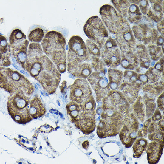 Calreticulin Rabbit pAb