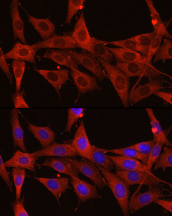 Calreticulin Rabbit pAb
