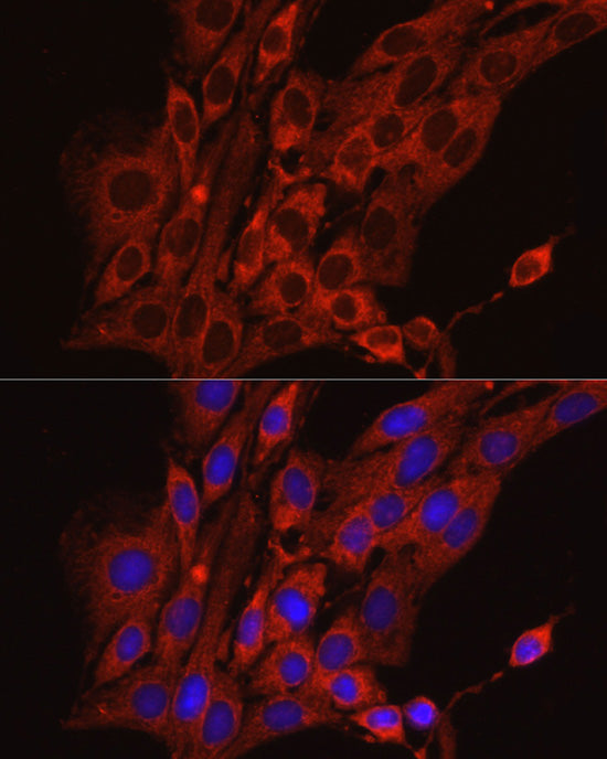 Calreticulin Rabbit pAb