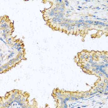 RNASE13 Rabbit pAb