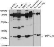 LAPTM4B Rabbit pAb