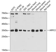ARPC2 Rabbit pAb