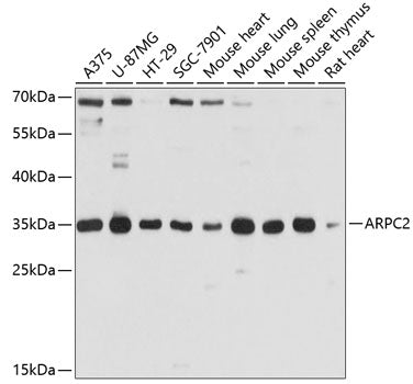 ARPC2 Rabbit pAb