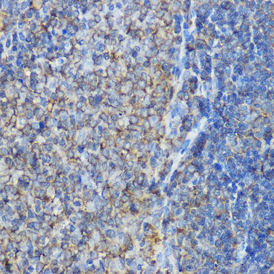 ARPC2 Rabbit pAb