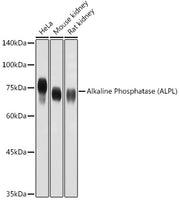 Alkaline Phosphatase (ALPL) Rabbit pAb