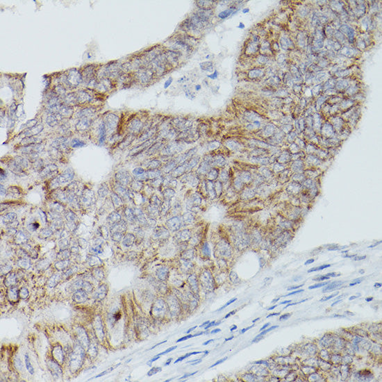 Alkaline Phosphatase (ALPL) Rabbit pAb