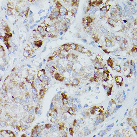 Alkaline Phosphatase (ALPL) Rabbit pAb
