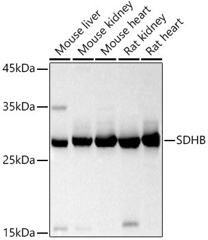 SDHB Rabbit pAb