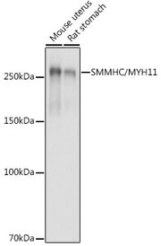 SMMHC/MYH11 Rabbit pAb