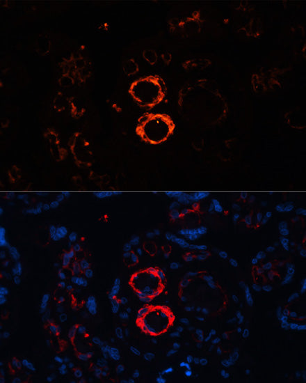 SMMHC/MYH11 Rabbit pAb