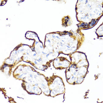 HSD17B1 Rabbit pAb