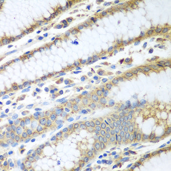 ERp57 Rabbit pAb