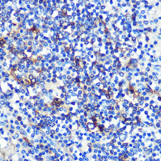 HLA-DRA Rabbit mAb