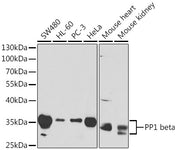 PP1 beta Rabbit pAb