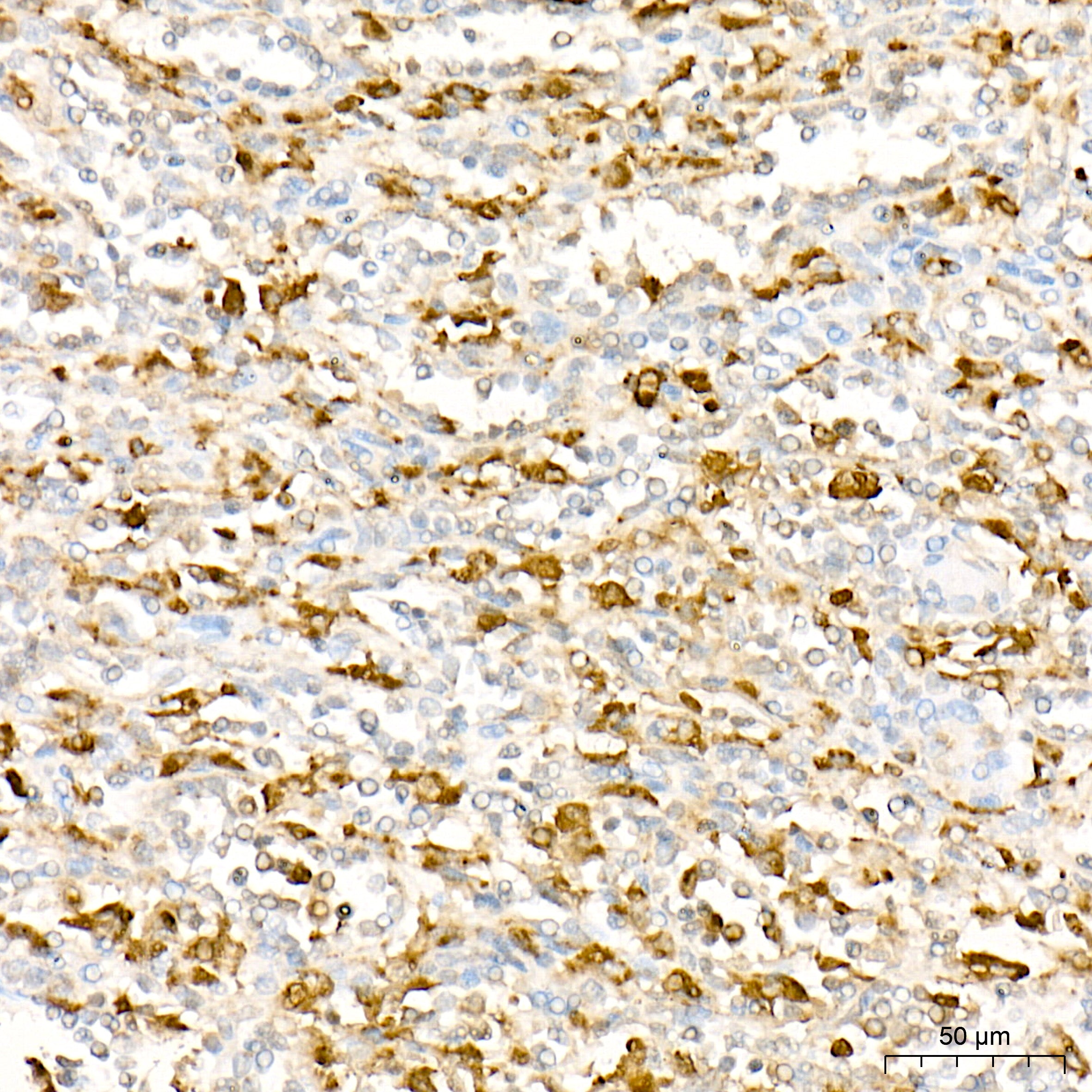 Lysozyme (LYZ) Rabbit mAb