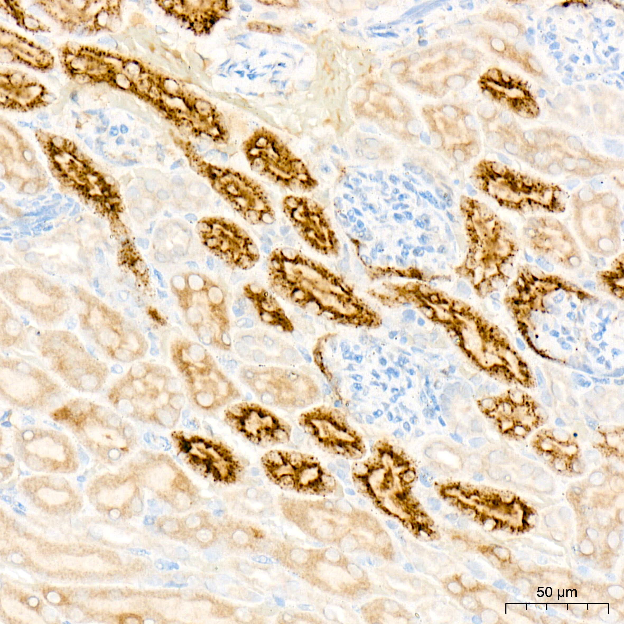 Lysozyme (LYZ) Rabbit mAb