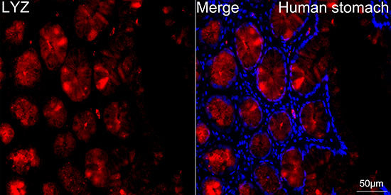 Lysozyme (LYZ) Rabbit mAb