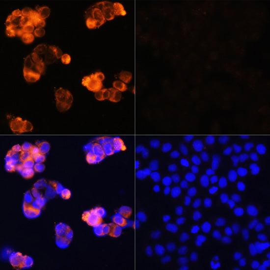 Alpha-Fetoprotein (AFP) Rabbit pAb