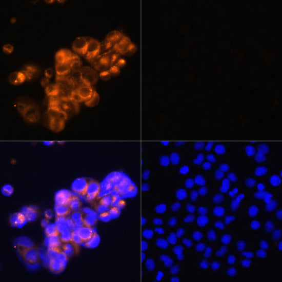 Alpha-Fetoprotein (AFP) Rabbit pAb