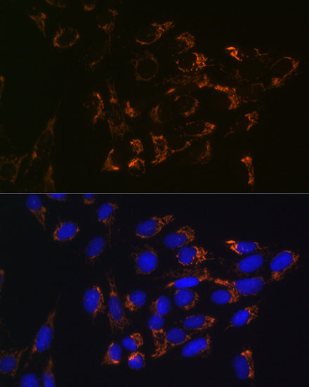Glutaminase (GLS) Rabbit mAb