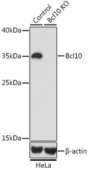 [KO Validated] Bcl10 Rabbit pAb