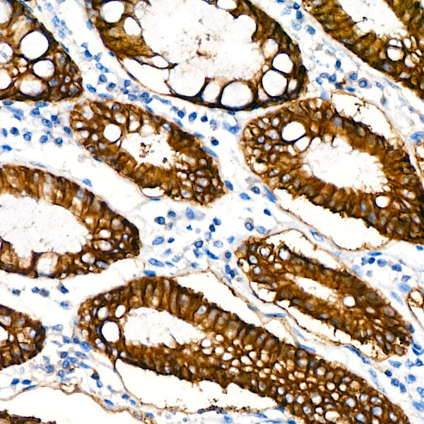 EpCAM Rabbit mAb