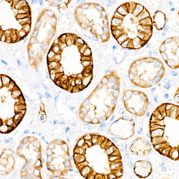 EpCAM Rabbit mAb