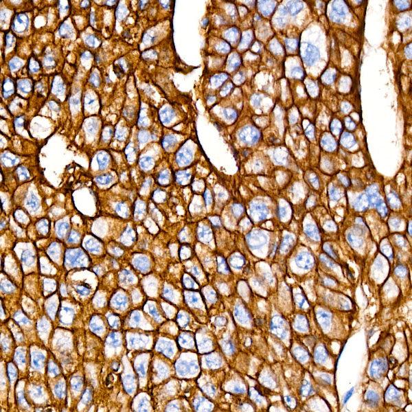 EpCAM Rabbit mAb